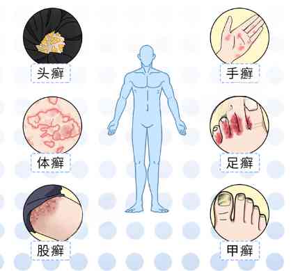 去玩一次水回来就得了妇科病公共泳池到底有多脏 配图13