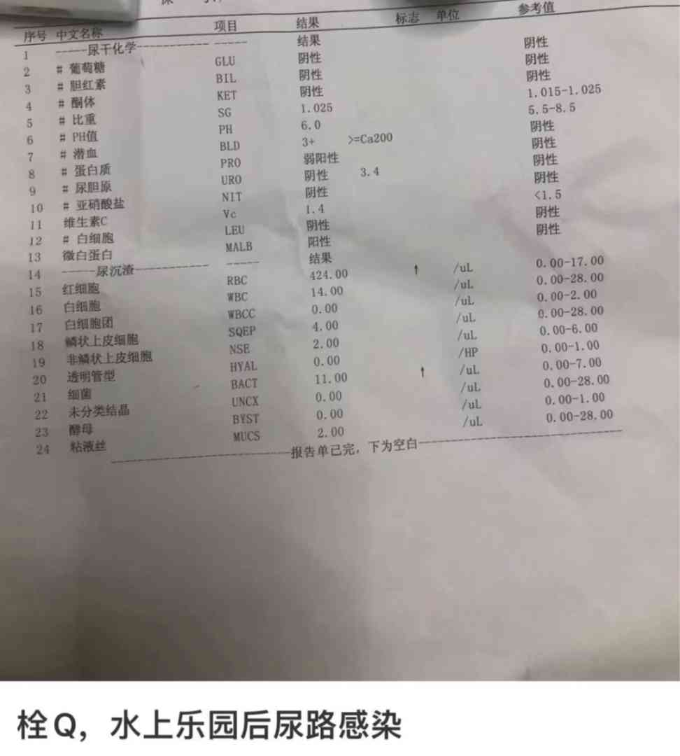 去玩一次水回来就得了妇科病公共泳池到底有多脏 配图2